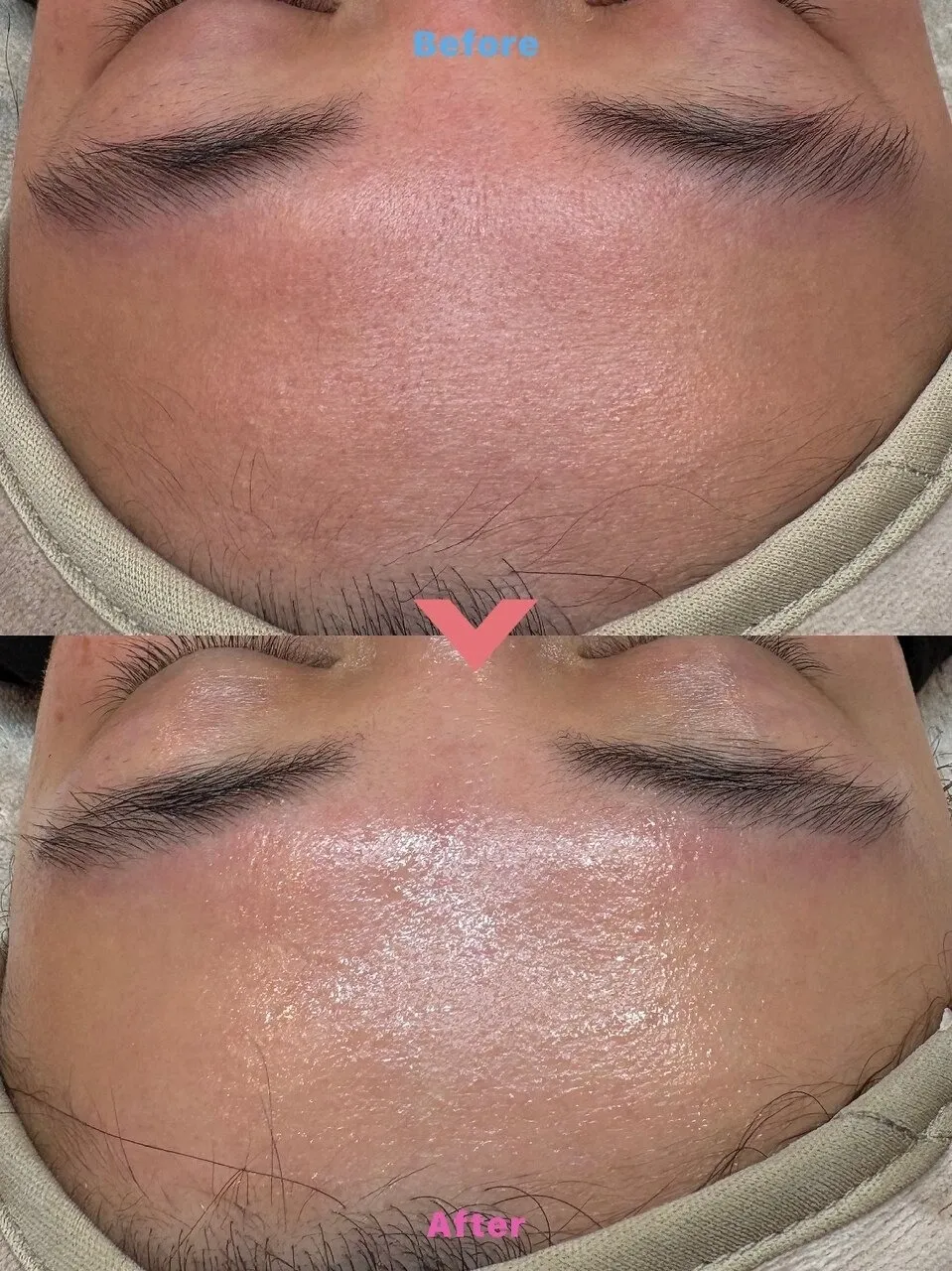 NUCLAIREフェイシャルワックス♪