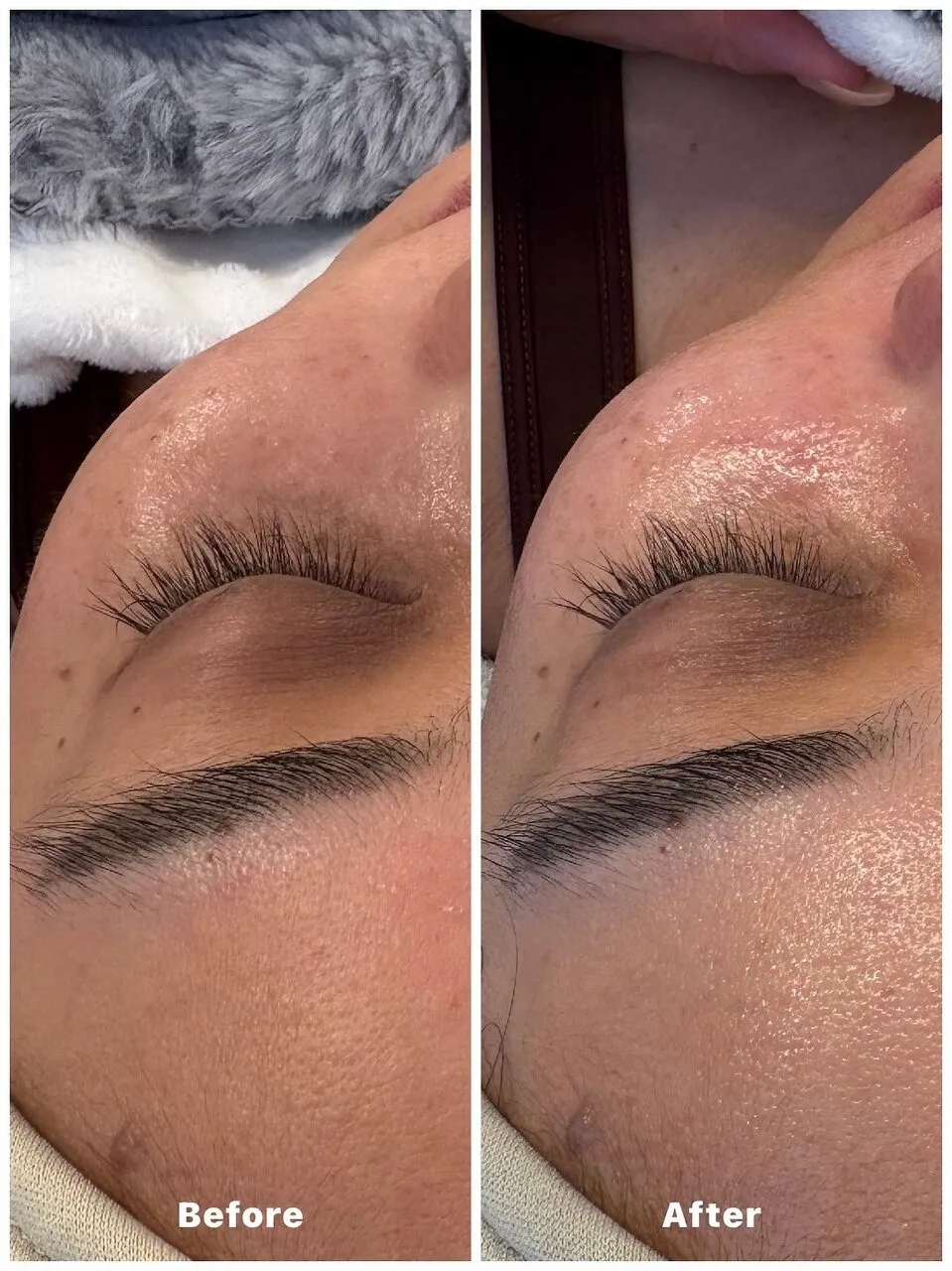 ダクトピール◎肌の内部再生♪