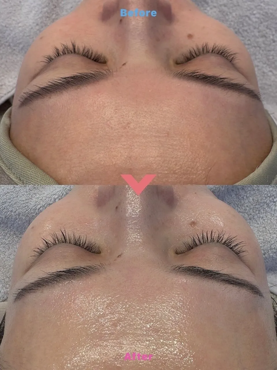 即効性◎エステ版ポテンツァ★